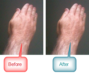 AuraBand_Before_After AuraBand_Before_After